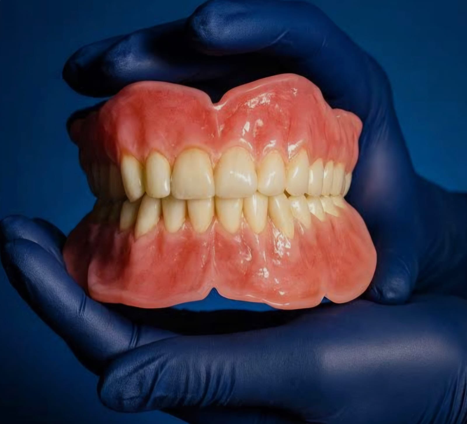 Denture dental treatment
